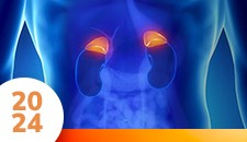 Carcinomas da Adrenal, Feocromocitomas e Paragangliomas