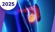 Testiculos