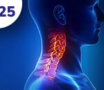 Cabeça e pescoço: doença recorrente metastática