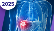 Carcinoma hepatocelular