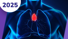 Neoplasias malignas do timo