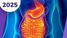 Tumores neuroendócrinos bem diferenciados: gastrointestinal